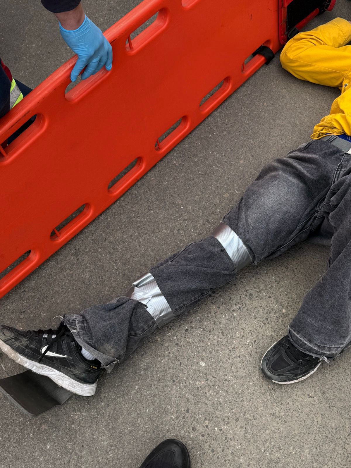 фото: травмована дитина